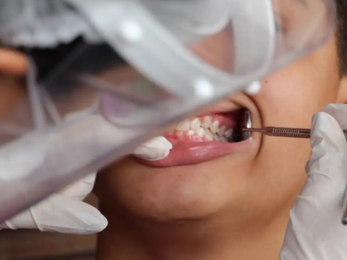 Governo Federal apresenta relatório de cobertura da saúde bucal